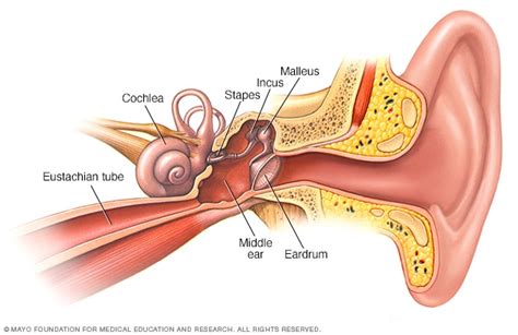 Ruptured eardrum (perforated eardrum) - Symptoms & causes - Mayo Clinic