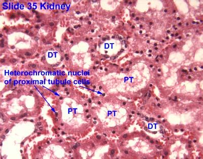 Renal Tubule Histology