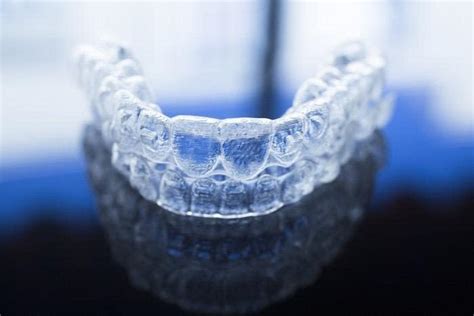 Invisalign - Teeth Straightening - Santa Clarita Dentist - Best Image ...