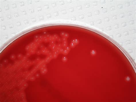 Streptococcus agalactiae Virtual Lab Microbiology