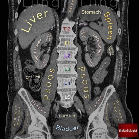 Anatomical structures on CT abdomen : r/Anatomy