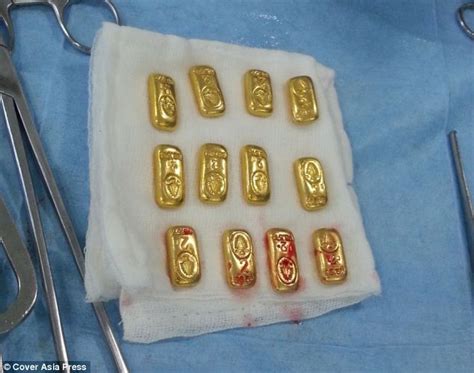 Bad idea: Indian businessman almost killed by its gold