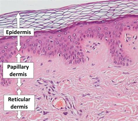 What is the Difference Between Papillary and Reticular Dermis - Pediaa.Com