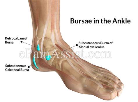 Ankle Joint Bursitis|Causes|Symptoms|Treatment-Conservative, PT, NSAIDs ...