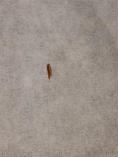 A wood splinter? I think?? : r/popping