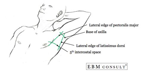 Chest Tube Placement Thoracostomy Procedure