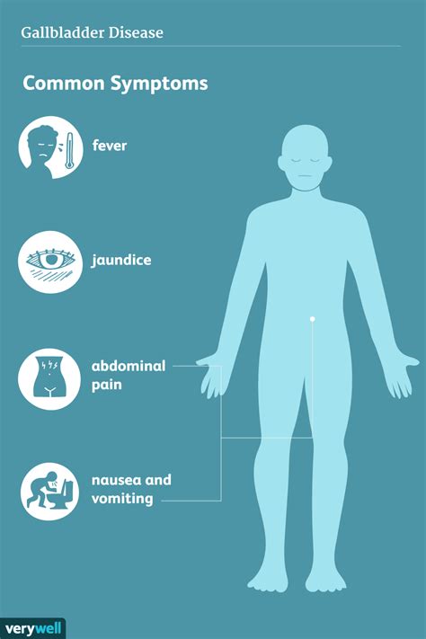 What Are the Symptoms of Gallbladder Disease? (2022)