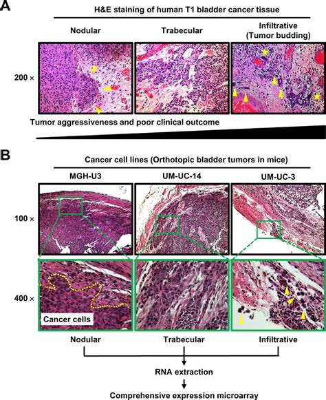 Representative images of H&E-stained specimens of three tumor growth ...