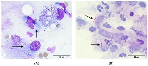 Pathogens | Free Full-Text | Systemic Mycobacterium kansasii Infection ...