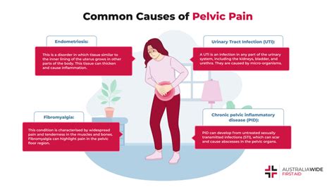 Understanding Chronic Pelvic Pain: Causes And Treatments - Ask The ...