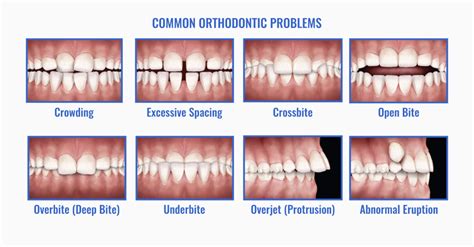 Common Orthodontic Problems