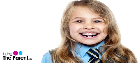 10 Different Types Of Braces For Your Kids - Being The Parent