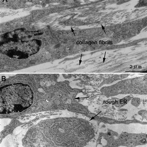 A–C Bone formation in collagen hybrid PLGA sponge. Macroscopic ...