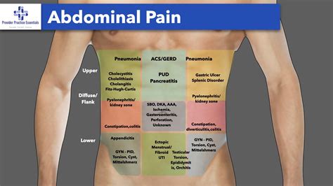 Performing a Thorough Abdominal Exam - A Step by Step Guide