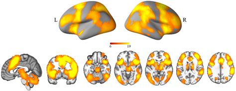 Brain activation maps for general response inhibition on whole ...