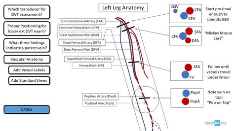 Deep Vein Thrombosis (DVT) | POCUS | teachIM