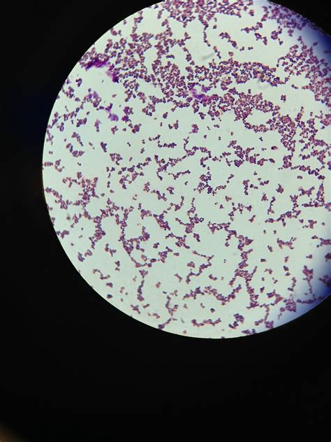 Staphylococcus aureus, Gram-positive stain, 1000x oil imme… | Flickr