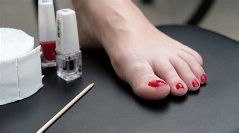 What You Didn’t Know About Supplements and Toenail Fungus - The Health ...