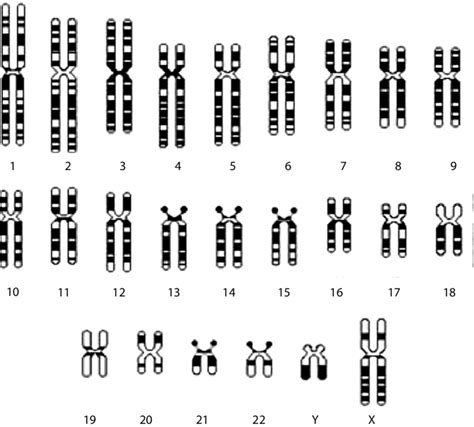 Diagrammatical representation of the human karyotype of haploid ...