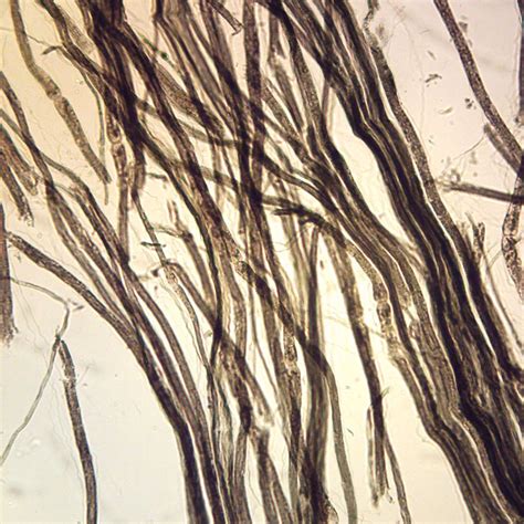 Mammal Nerve Fibers, teased Microscope Slide | Carolina Biological Supply