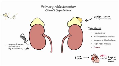 Aldosterone Mechanism of Action - YouTube