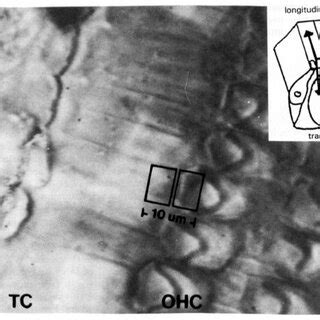 (PDF) High frequency radial movements of the reticular lamina induced ...