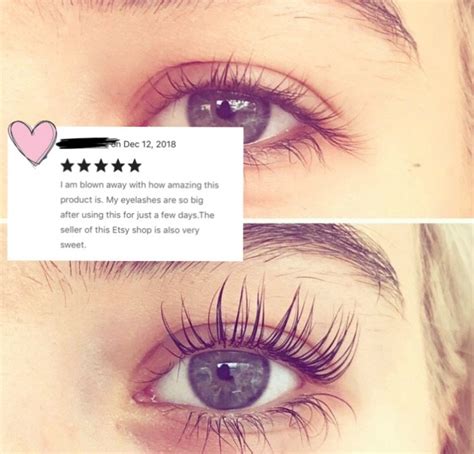 Eyelash Growth Serum - Etsy