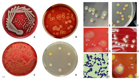 Staphylococcus Aureus Culture Media