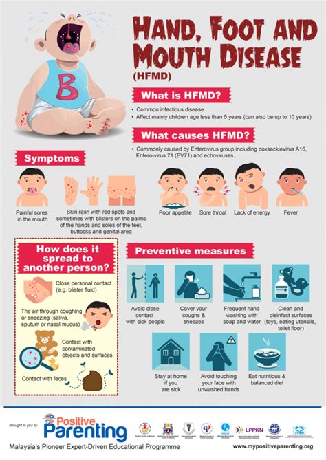 What is Hand, Foot and Mouth Disease (HFMD) and how to prevent it?