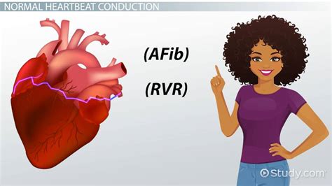 Afib With Rvr Treatment