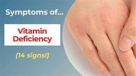 Top 14 Symptoms of Vitamin Deficiency — Eating Enlightenment