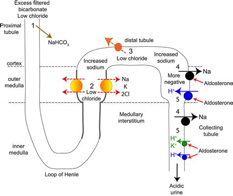 Renal contribution to metabolic alkalosis | eClinpath