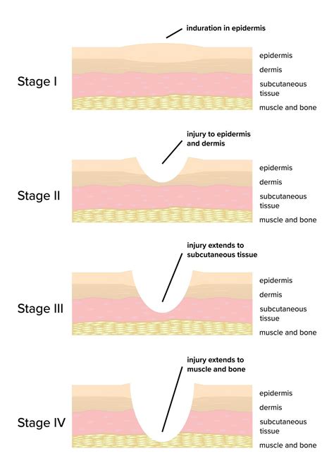 When faced with a complex instance of wound care, many first time or ...