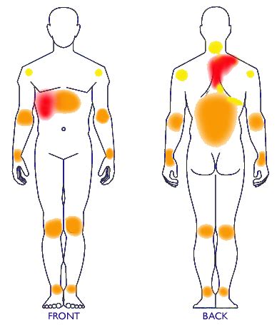 Gallbladder Symptoms | Gallbladder Attack in Canada & the USA!