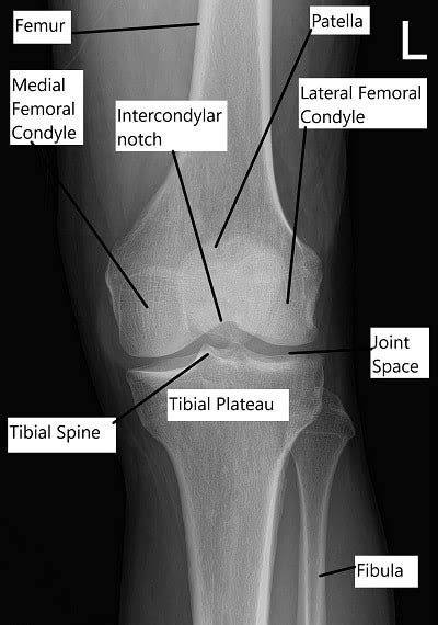 Knee Anatomy - Complete Orthopedics | Multiple NY Locations