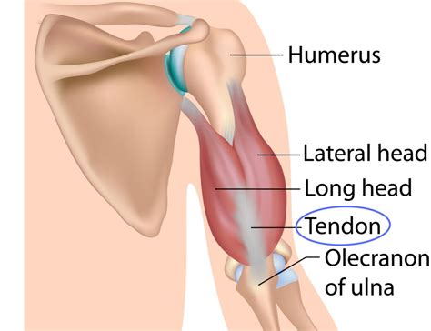 Triceps Tendonitis: The Weightlifter's Elbow - Sport Doctor London