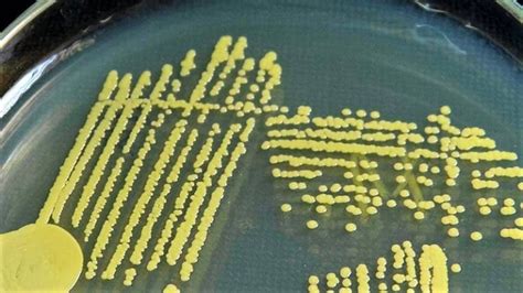 Morphology & Cultural Characteristics of Staphylococcus aureus