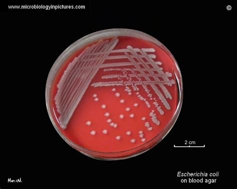 E. coli (Escherichia coli)- An Overview - Microbe Notes