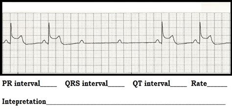 Ekg Practice Strips Printable