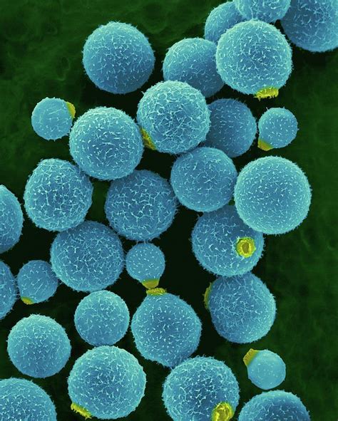 Cryptococcus Neoformans #1 Photograph by Science Photo Library - Pixels