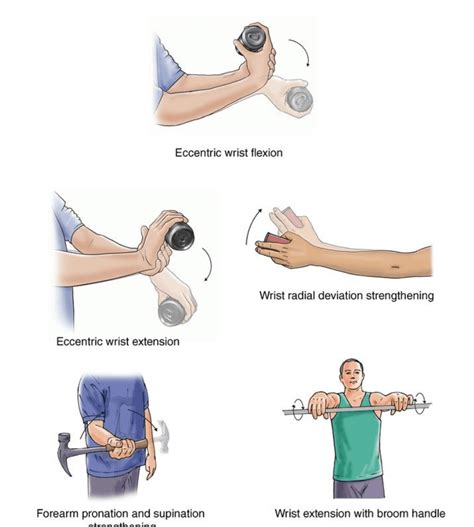 Elbow Exercises – GMphysio