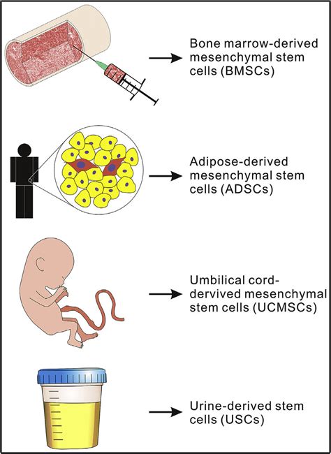 Osteoblastic stem cell sources. The potential sources of mesenchymal ...