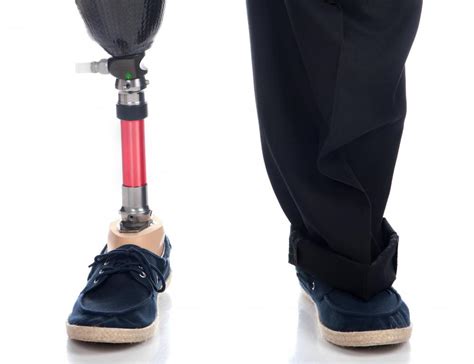 What is a Prosthetic Foot? (with pictures)