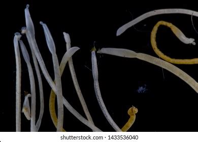 Study Acanthocephala Phylum Parasitic Worms Known Stock Photo ...