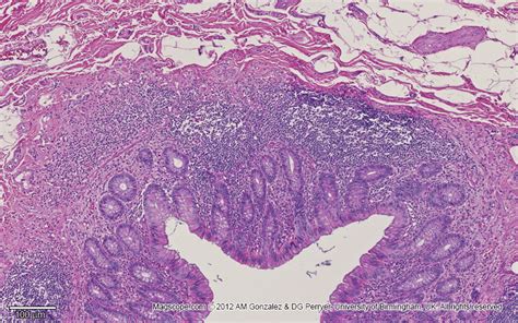 Low magnification image of the transversal section of the appendix ...