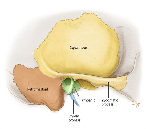 Temporal Bone Diagram