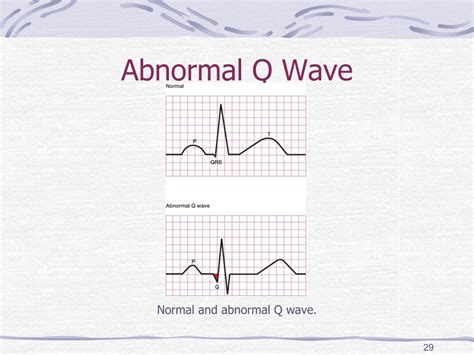 Abnormal Q Wave