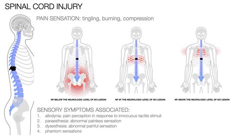 Biomedicines | Free Full-Text | Future Treatment of Neuropathic Pain in ...