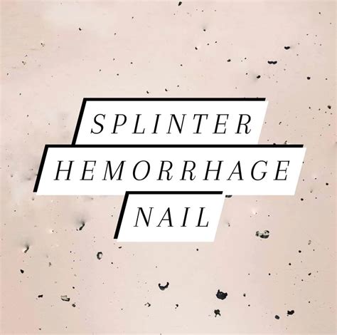 #splinter... - The Chelsea Clinic Chiropodists - Podiatrists | Facebook