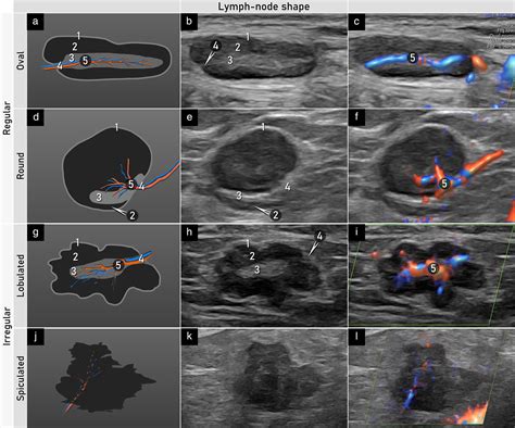 Pin by Scarlett Maldonado on Sonography | Breast ultrasound, Ultrasound ...